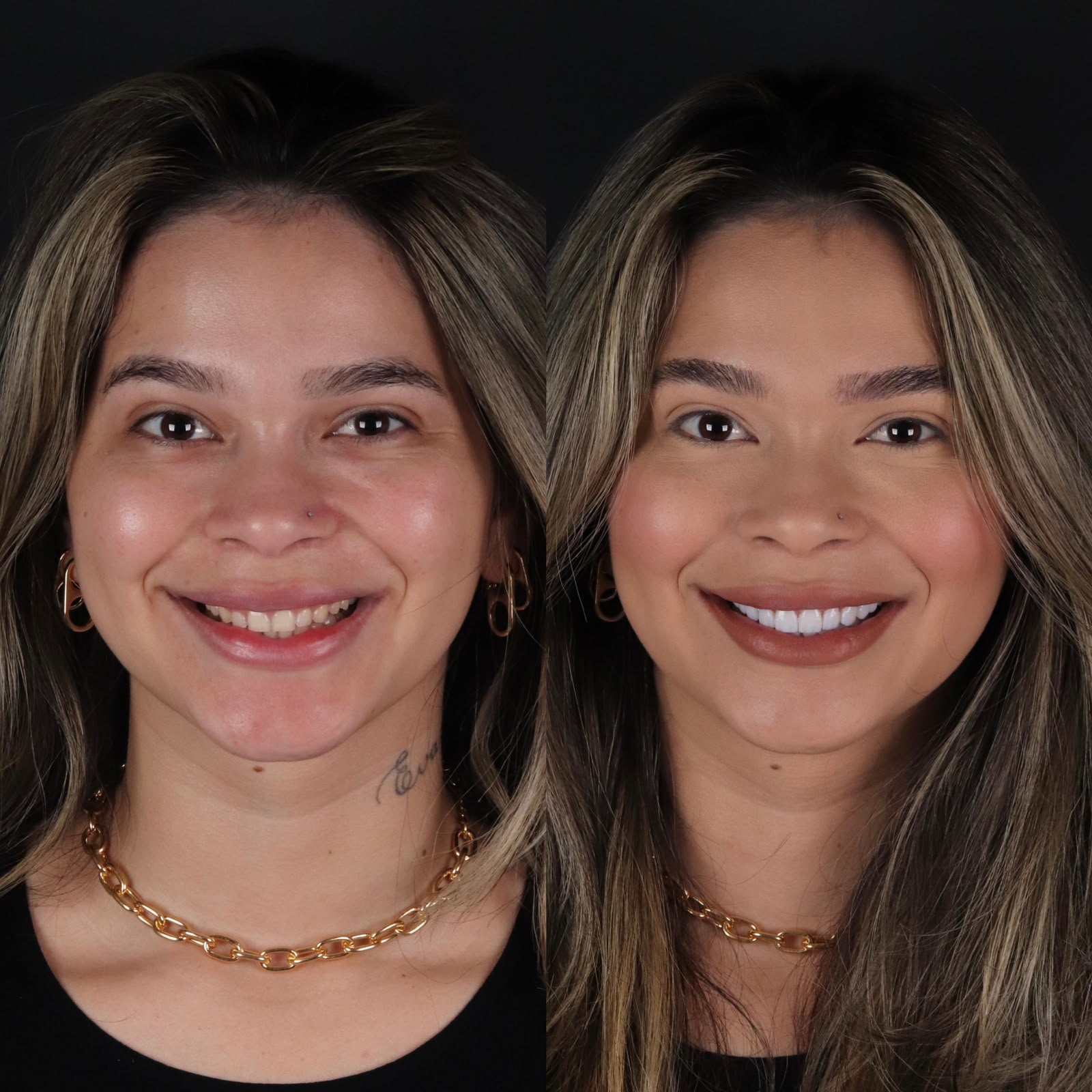 Antes e depois — caso 1